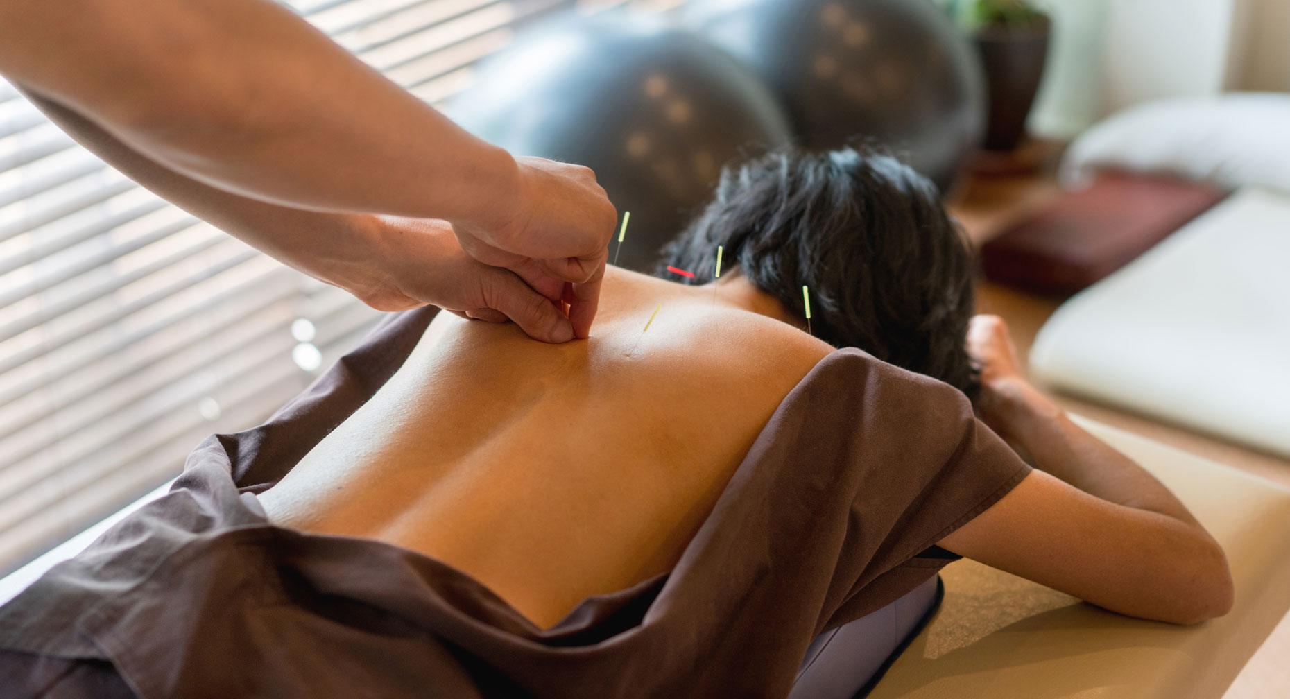Acupuncture for Stress &amp; Anxiety