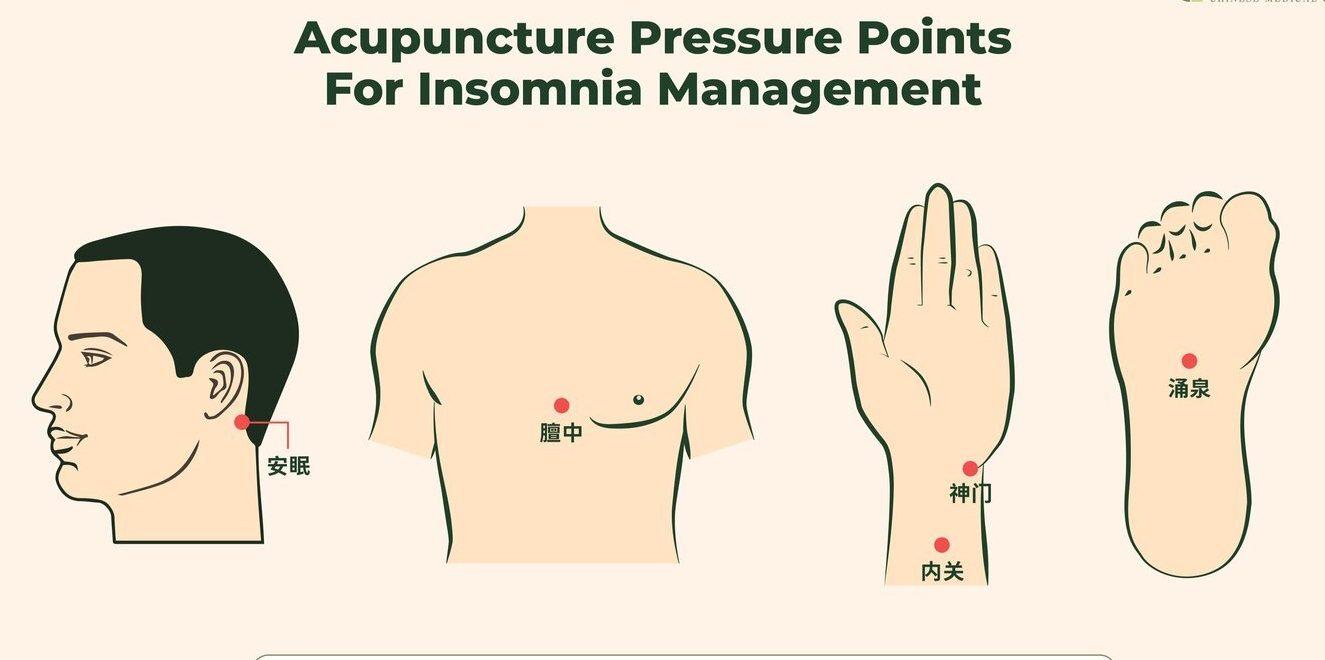 Acupuncture for Better Sleep